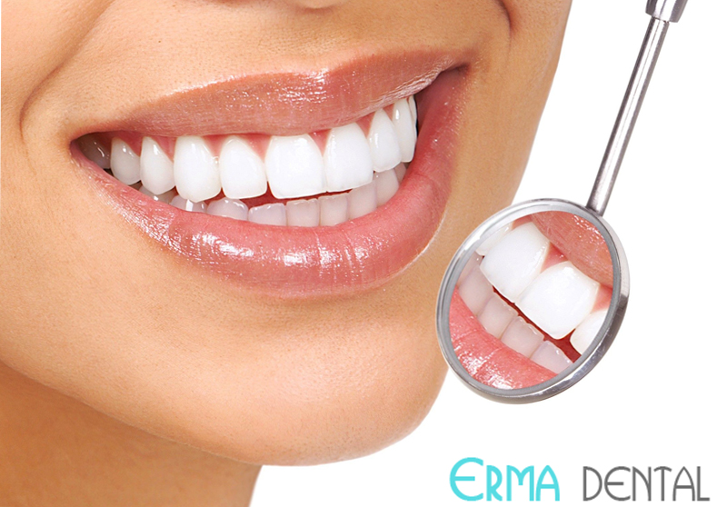 cheap teeth whitening and bleaching in Bulgaria